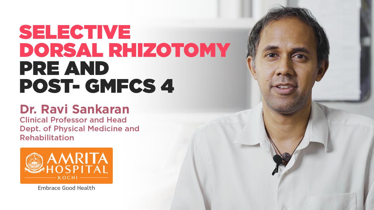 Selective Dorsal Rhizotomy pre and post- GMFCS 4