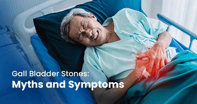 10 Common Myths About Gallbladder Stones