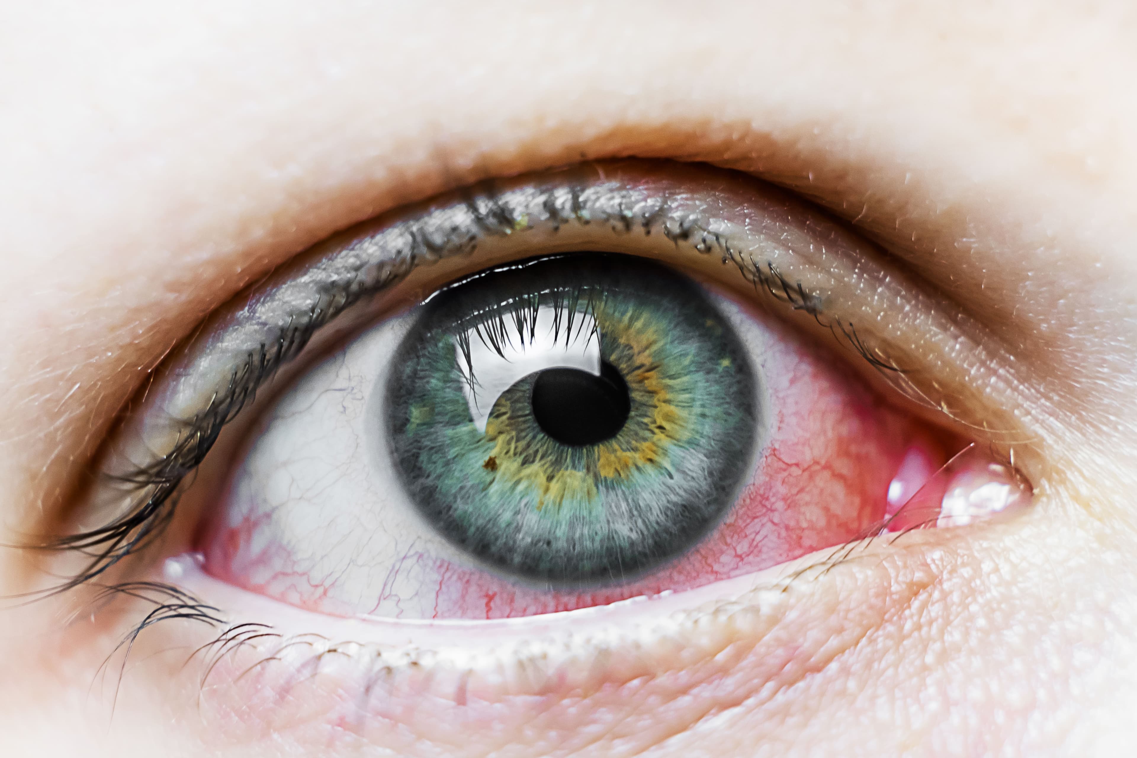 Understanding and Managing Diabetic Retinopathy: A Comprehensive Guide