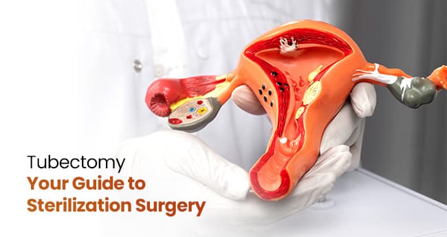 Tubectomy Surgery: Types, Procedure, and Recovery