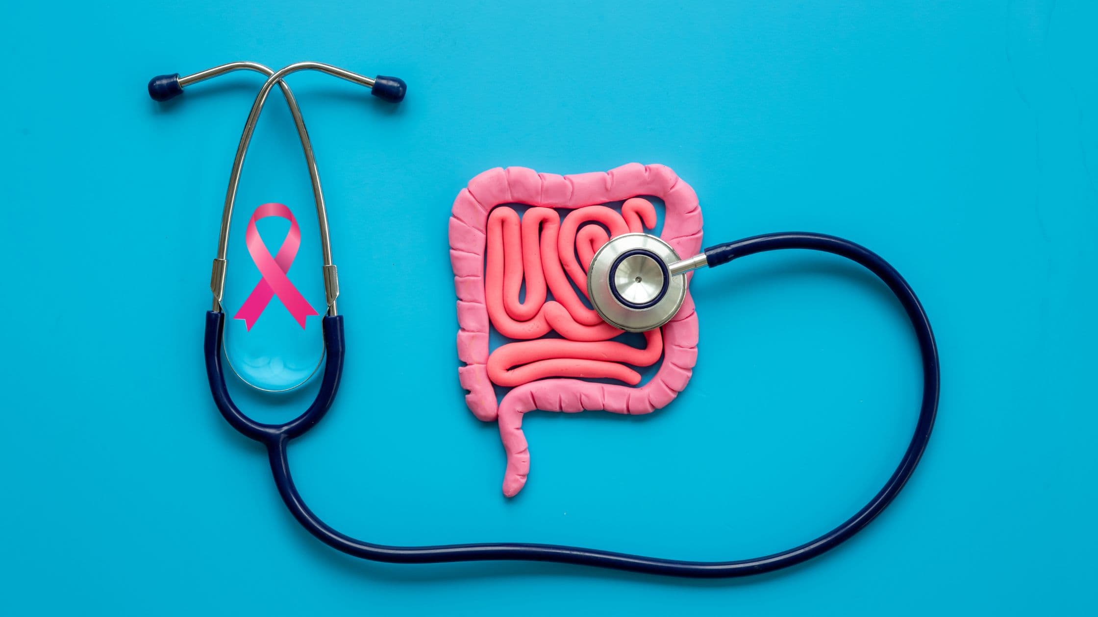 Understanding Colorectal Cancer and the Need for Screening