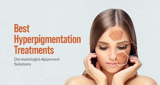 Best Hyperpigmentation Treatments — Dermatologist-Approved Solutions