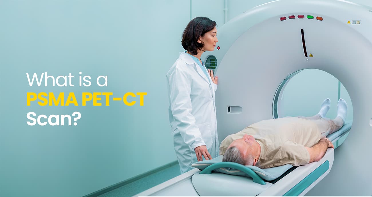 PSMA PET-CT Scan: A Breakthrough in Prostate Cancer Imaging and Diagnosis